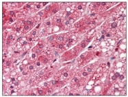 AM03118PU-N - PPP1CA