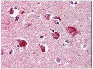 AM03118PU-N - PPP1CA