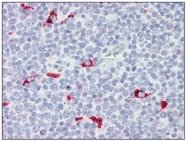 AM03127PU-N - IRF7