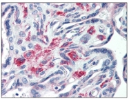 AM20113PU-N - Syntaxin 12 / STX12