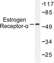 AP06108PU-N - Estrogen receptor alpha