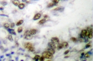 AP06108PU-N - Estrogen receptor alpha