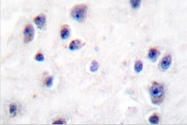 AP06129PU-N - GABRB1