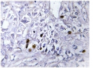 AP06694PU-N - CBX5