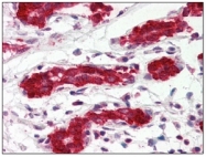 AM09026PU-N - PDCD4