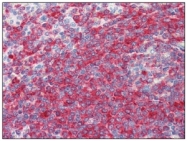 AM09026PU-N - PDCD4