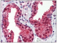 AM09029PU-N - PSMA / FOLH1