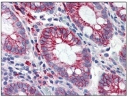 AM09002PU-N - CD29 / Integrin beta-1