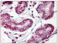 AM03178PU-N - CD44
