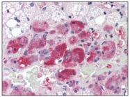 AM03186PU-N - Calmodulin