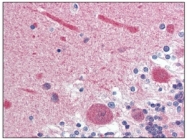 AM03186PU-N - Calmodulin
