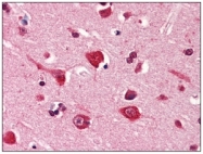 AM03203PU-S - Podoplanin