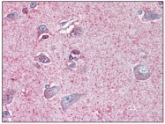 AP20070PU-N - Neurotensin receptor type 2