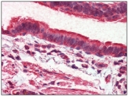 AP20072PU-N - GPR98 / MASS1