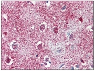 AP20077PU-N - TAO Kinase 1 (TAOK1)
