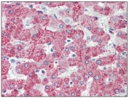 AP20077PU-N - TAO Kinase 1 (TAOK1)