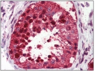 AP20085PU-N - USP2