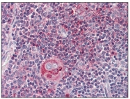 AP20087PU-N - WNT5B