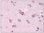 AM09000PU-N - Amyloid beta A4 protein / APP