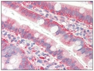 AM09056PU-N - Cofilin-1