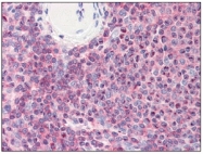 AM09056PU-N - Cofilin-1
