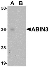 AP30005PU-N - TNIP3