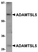 AP30018PU-N - ADAMTSL5