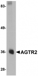 AP30027PU-N - Type-2 angiotensin II receptor (AT2)