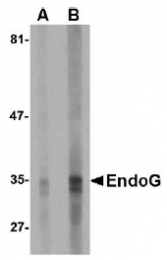 AM20129PU-N - Endonuclease G