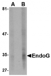 AM20131PU-N - Endonuclease G