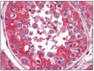 AM09008PU-N - EPHA2 / ECK