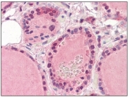 AM09008PU-N - EPHA2 / ECK