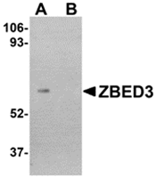 AP30996PU-N - ZBED3