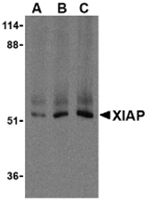 TA306170 - IAP3 / BIRC4