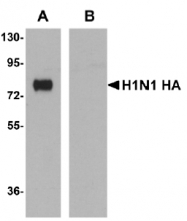 AM20156PU-N - Influenza A H1N1