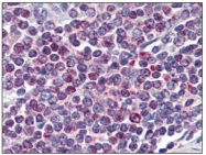 AM09061PU-N - NFAT2 / NFATC