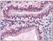 AM09062PU-N - CRABP2