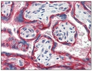 SM1602P - CD147