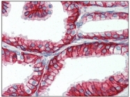 SM1602P - CD147