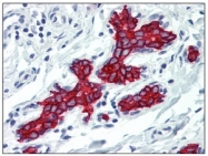 SM1822PS - Cytokeratin 19