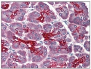 SM1822PS - Cytokeratin 19