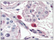 SM2251P - FCER1A