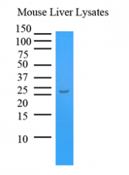 AM09365PU-N - Transthyretin / Prealbumin