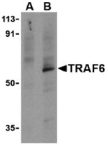 AP30938PU-N - TRAF6 / RNF85
