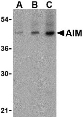AP30035PU-N - CD5L / API6