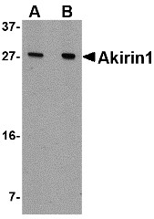 AP30038PU-N - AKIRIN1