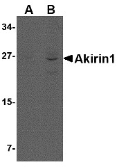 AP30039PU-N - AKIRIN1