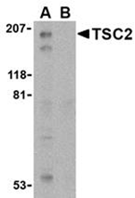 AP30961PU-N - Tuberin / TSC2
