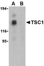 AP30960PU-N - TSC1 / Hamartin