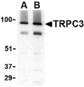 TA306352 - TRPC3 / TRP3
